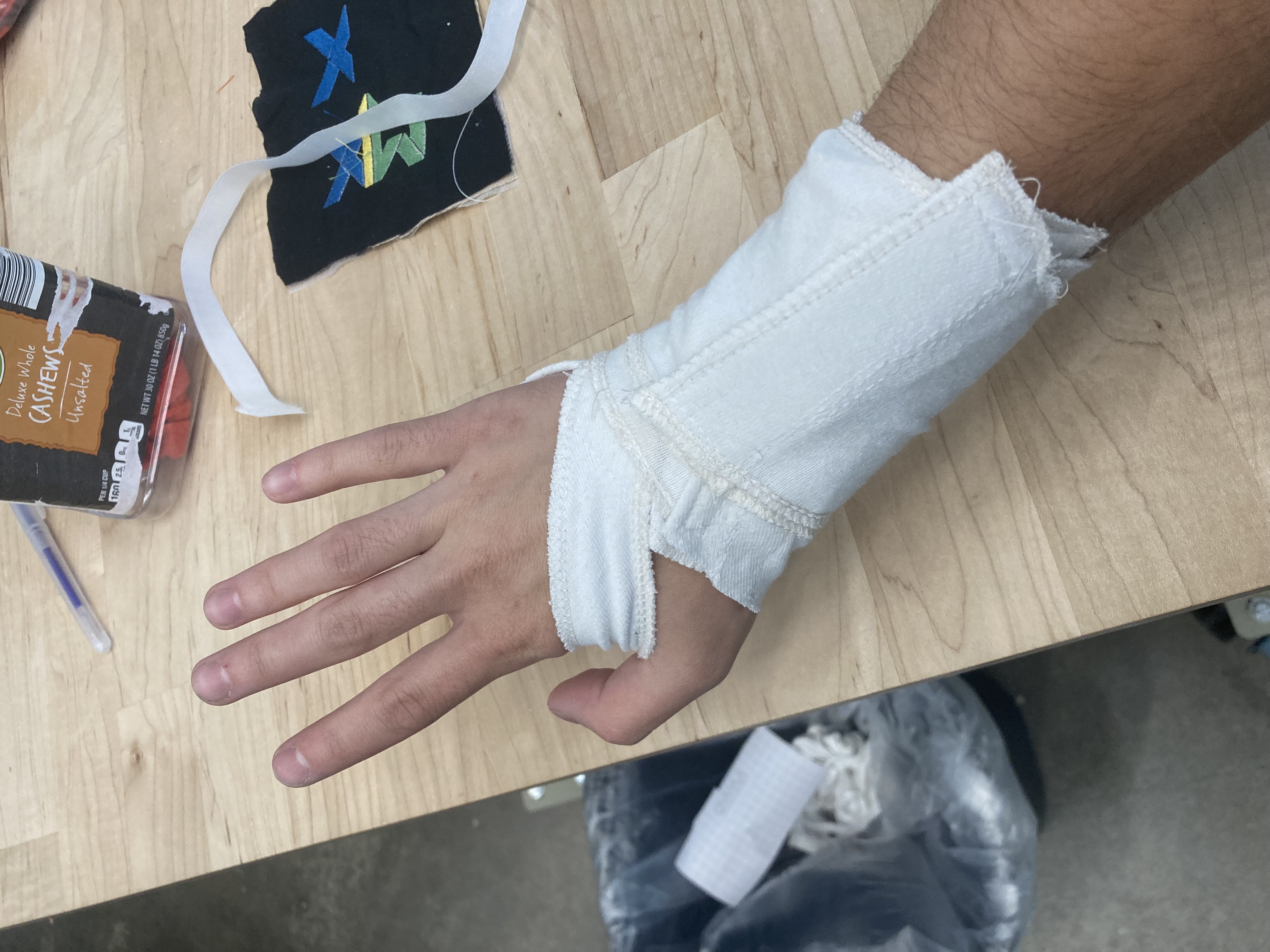 Bandage back of hand